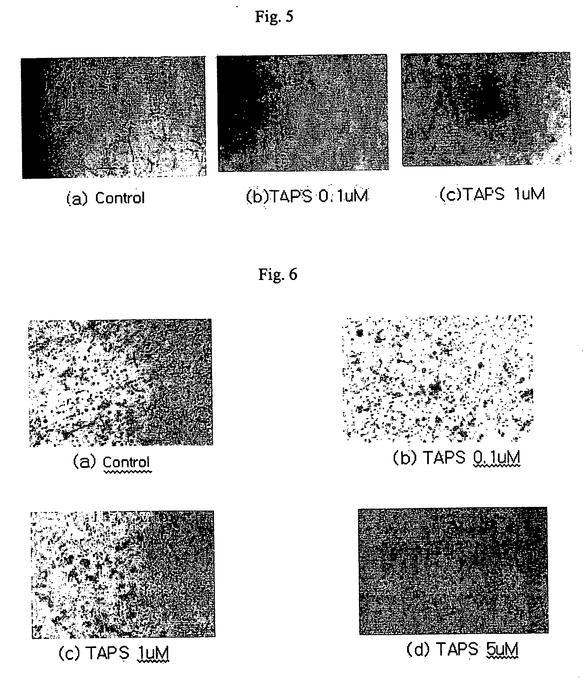 Inhibitor of angiogenesis and kit for treating cancer comprising the inhibitor
