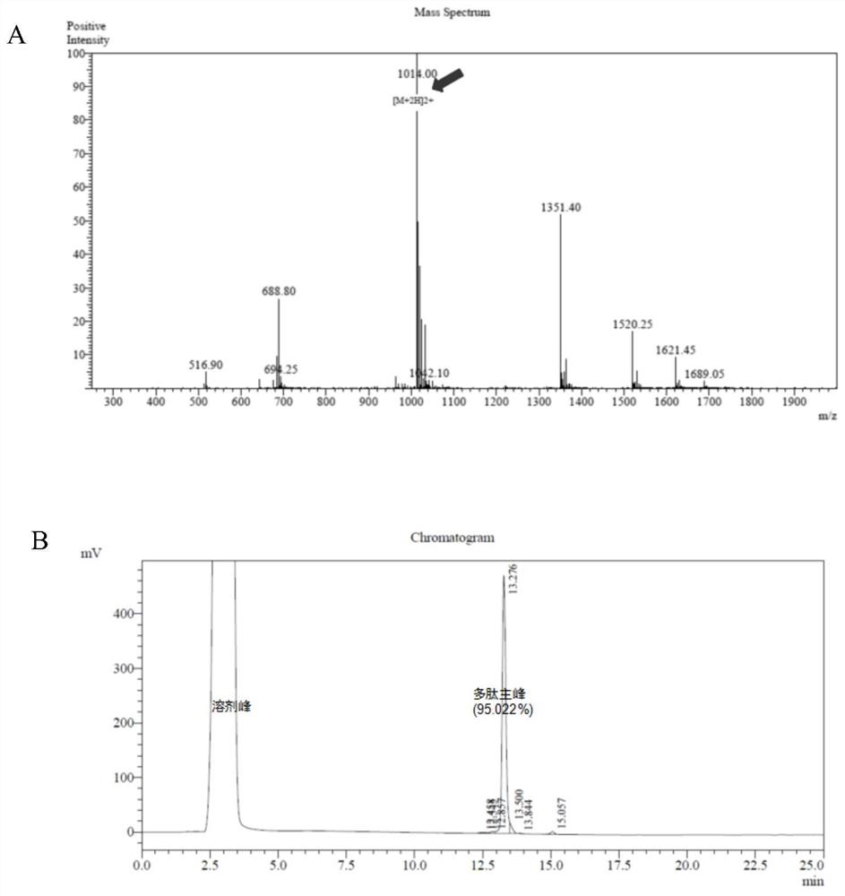 A polypeptide nanofiber hydrogel for slow release of exosomes and its preparation method and application