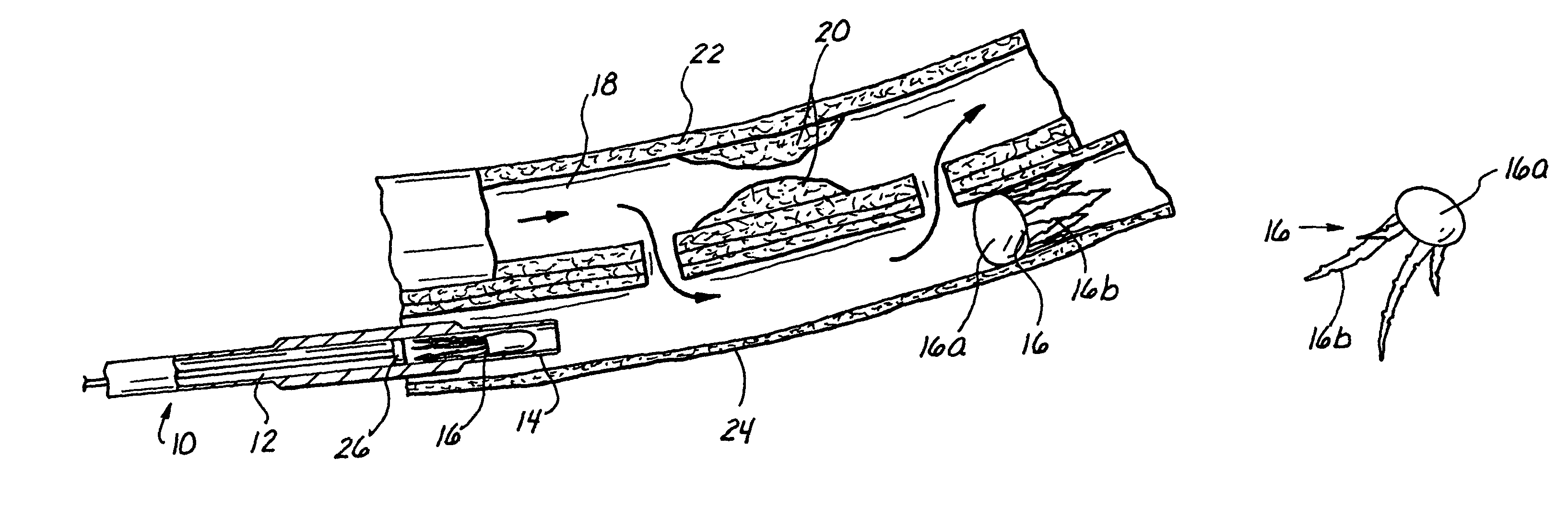 Methods and apparatus for blocking flow through blood vessels