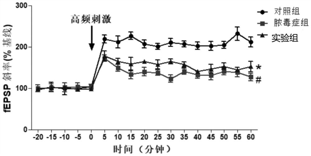 Traditional Chinese medicine composition for treating sepsis cognitive disorder and preparation method of composition