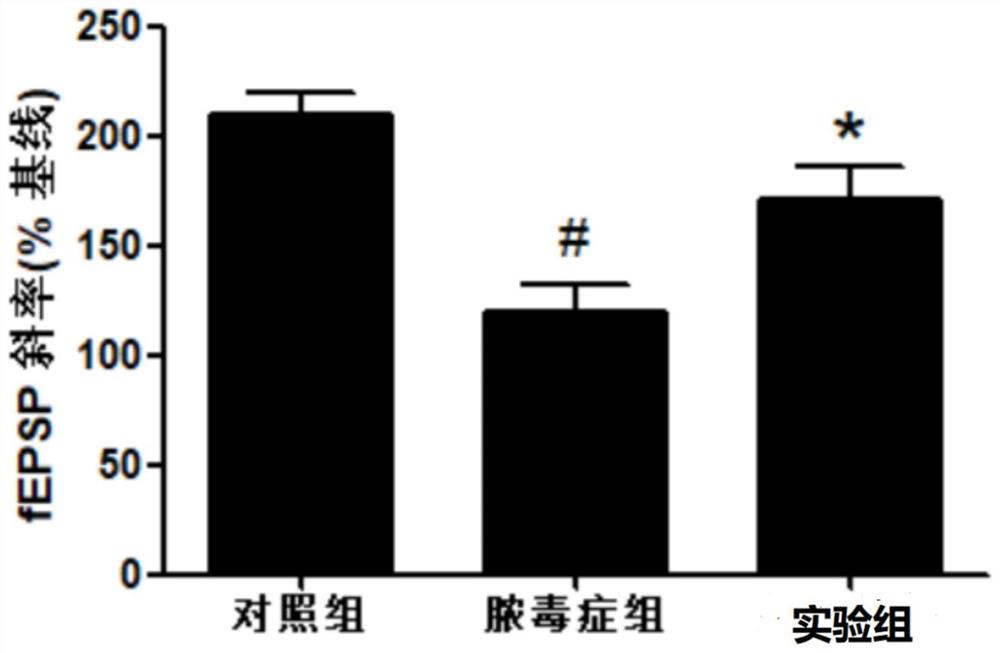 Traditional Chinese medicine composition for treating sepsis cognitive disorder and preparation method of composition