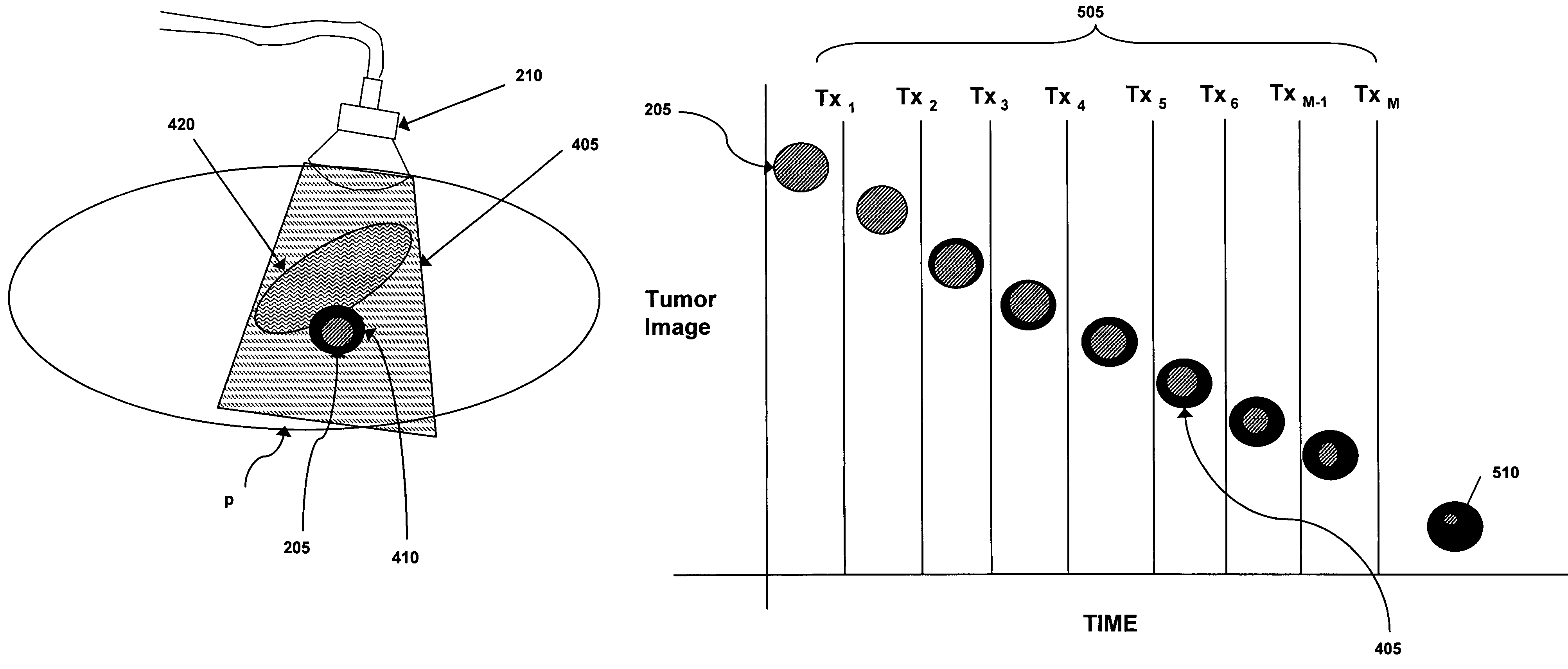 Radiotherapy treatment monitoring using ultrasound