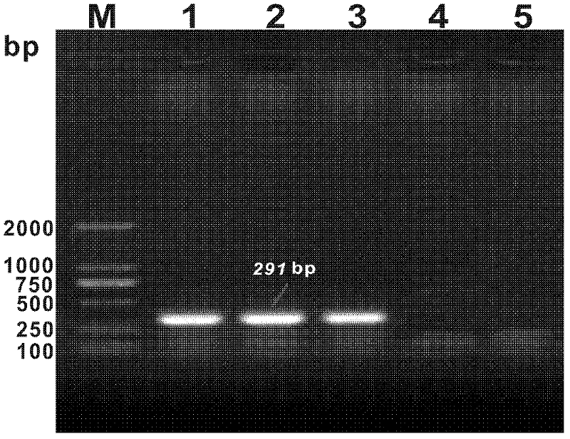 PCR (Polymerase Chain Reaction) method for detecting Baylisascaris schoederi eggs in panda excrement sample