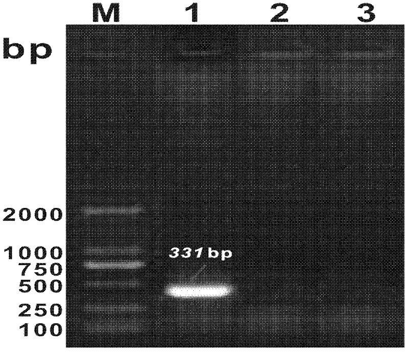 PCR (Polymerase Chain Reaction) method for detecting Baylisascaris schoederi eggs in panda excrement sample