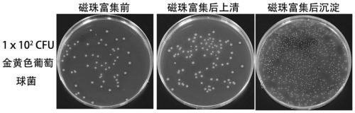 Bacterial detection kit and application thereof