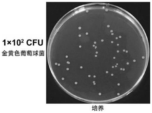 Bacterial detection kit and application thereof