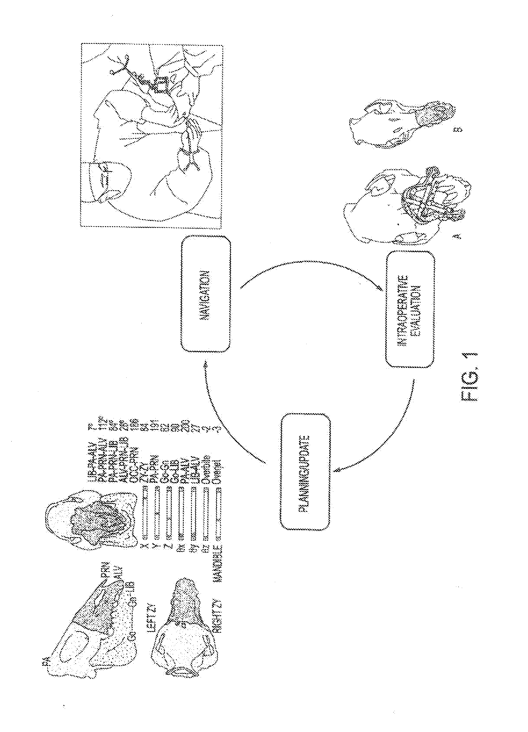 Computer-assisted planning and execution system