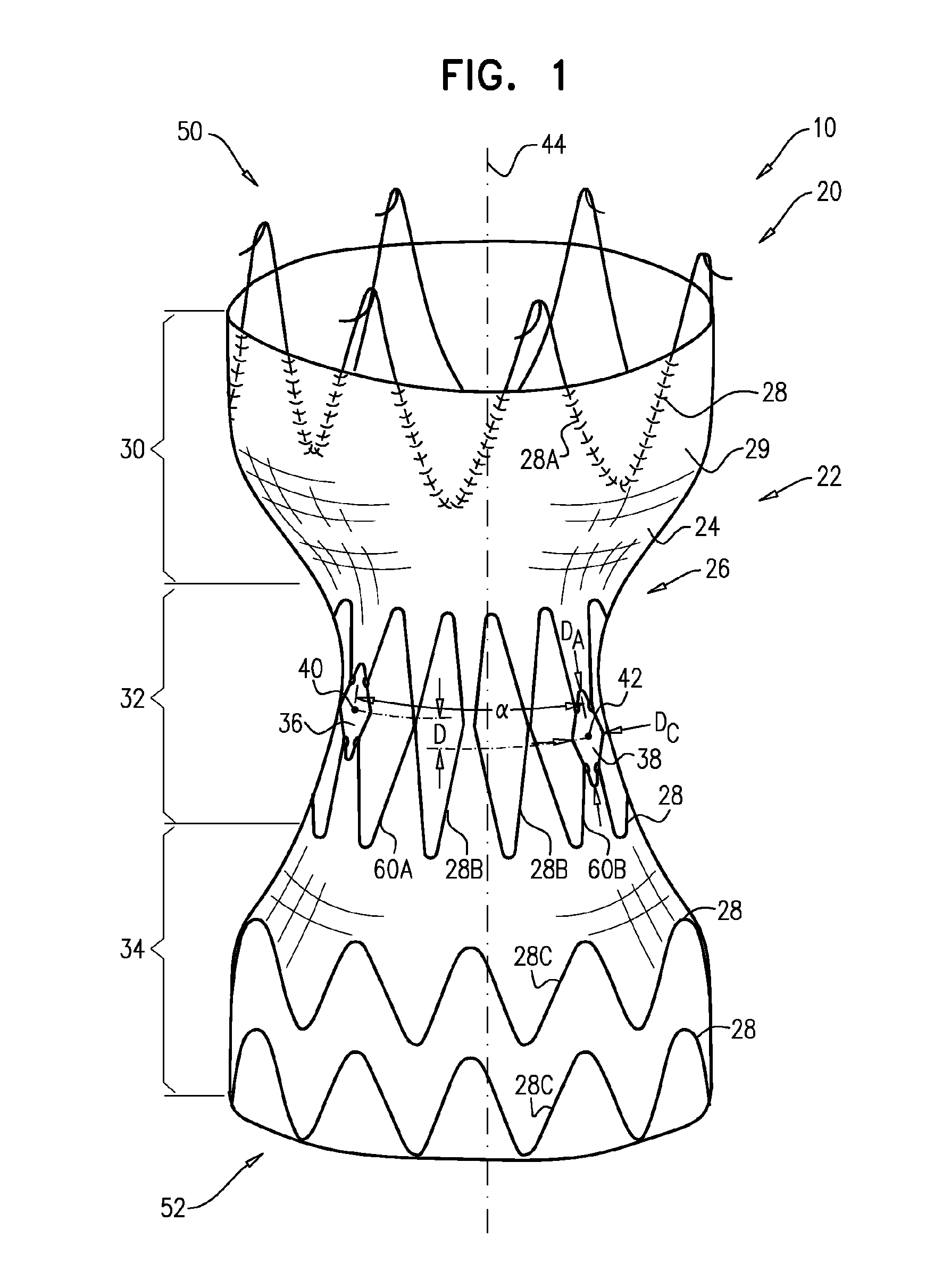 Branched stent-graft system