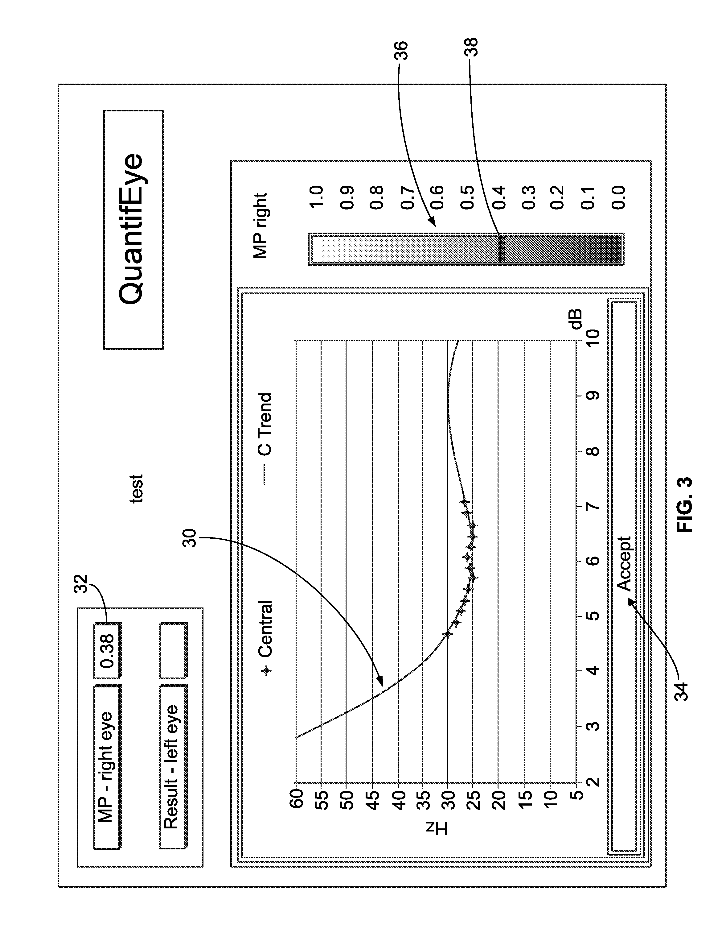Macular pigment measurement device with data quality indexing feature