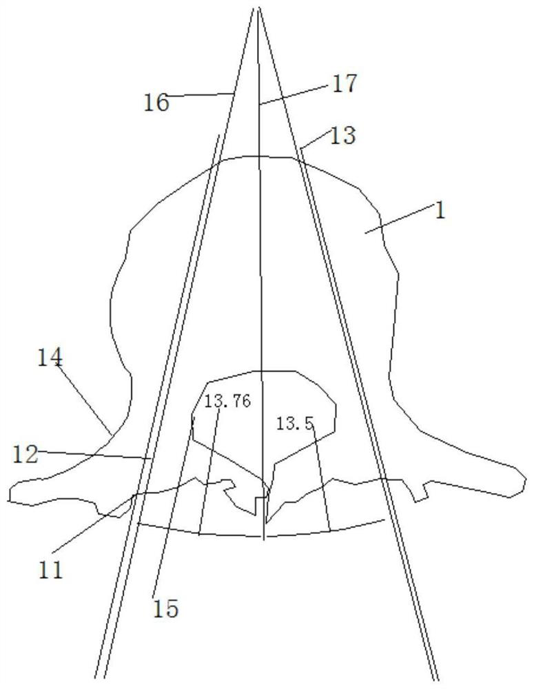 Simulation lumbar vertebra model for training low-age orthopedist to find optimal screw feeding point of lumbar pedicle screw and manufacturing method