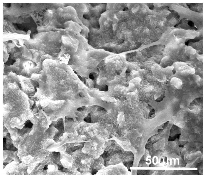 A kind of mesoporous bioactive glass/metal organic framework scaffold material and its preparation method