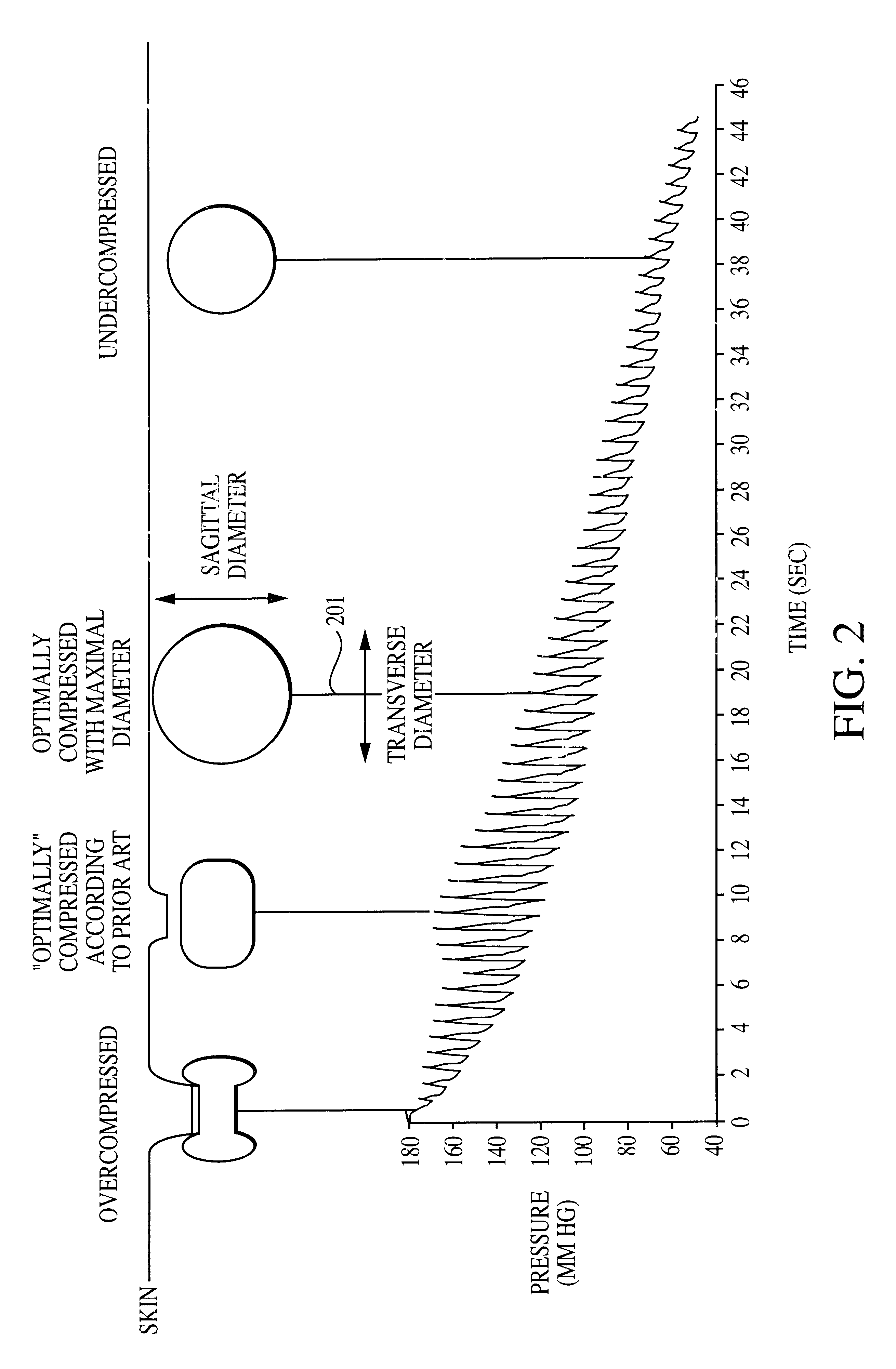 Method and apparatus for the noninvasive determination of arterial blood pressure