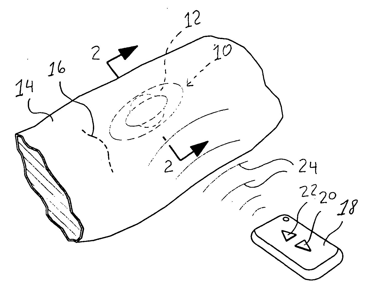 Tissue expander, system and method