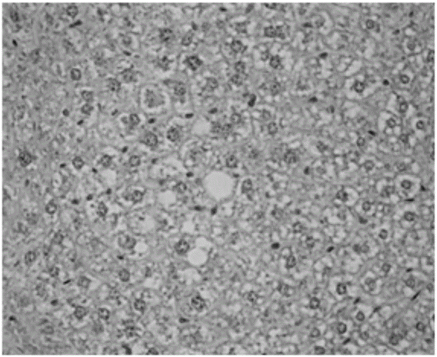 Method for establishment of non-alcoholic fatty liver disease model by utilizing ApoE-/-mice