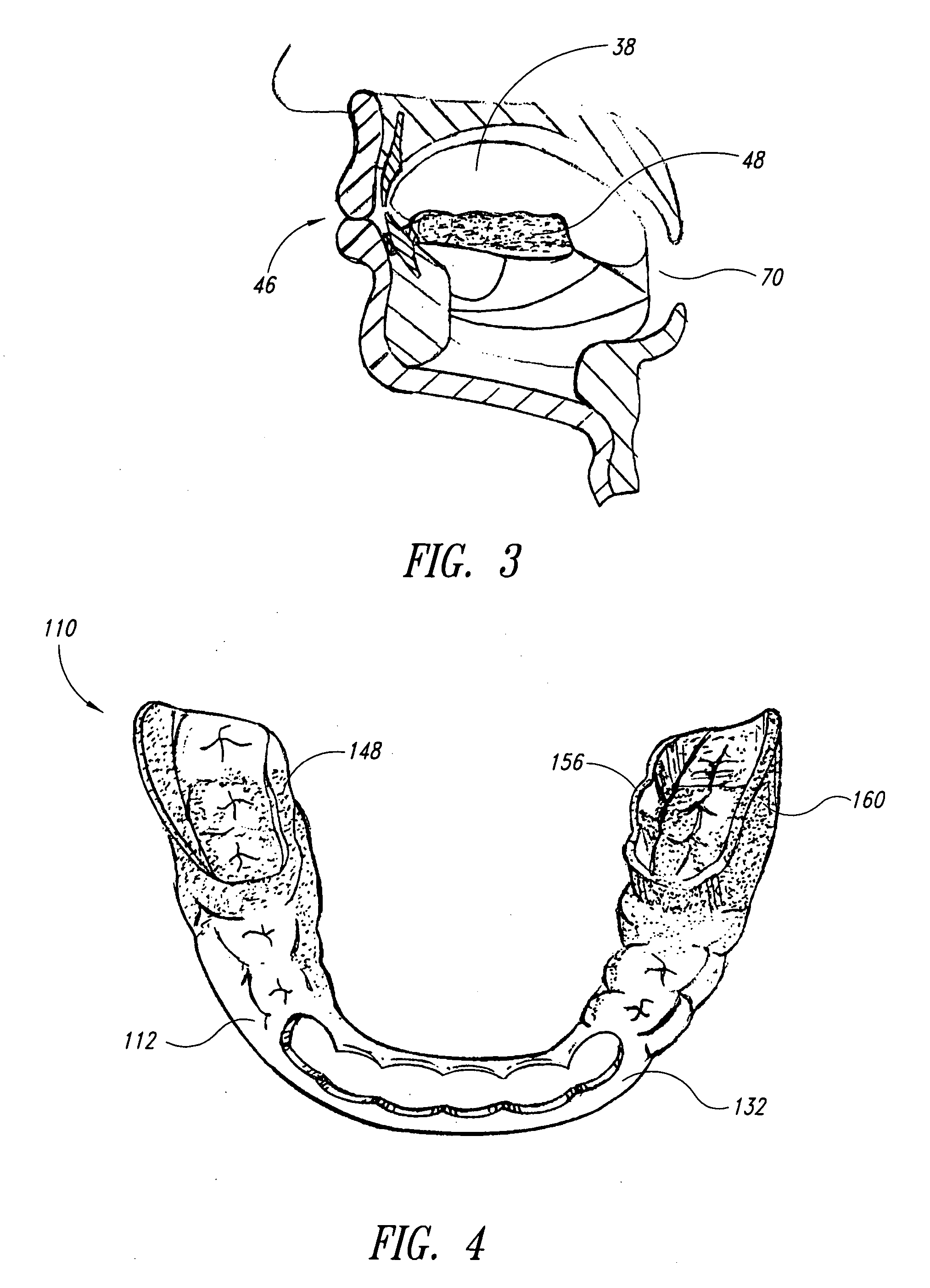 Dental orthotic devices and methods for management of impaired oral functions and resultant indications