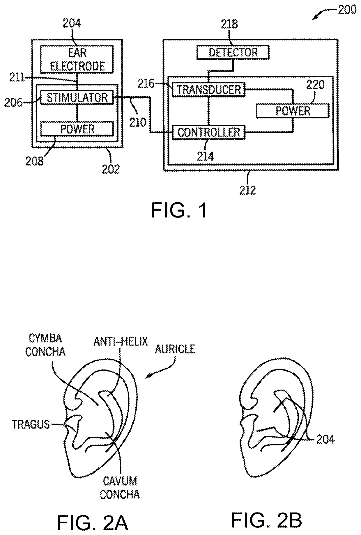Systems and methods for respiratory-gated nerve stimulation