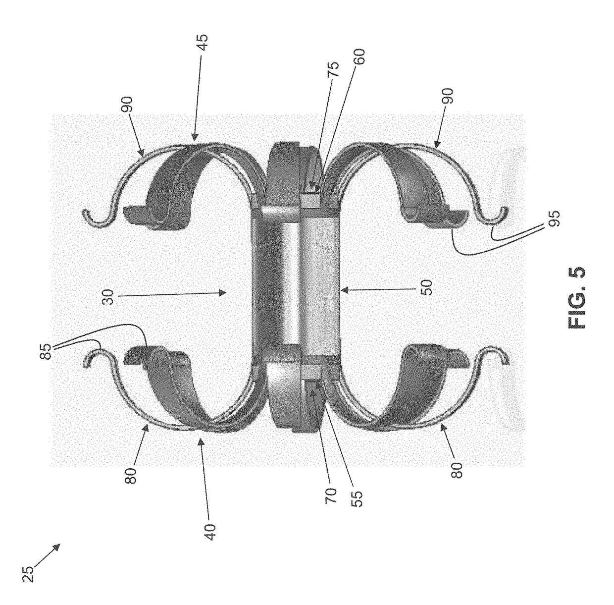 Method and apparatus for treating fluid build-up in a body cavity, including method and apparatus for treating ascites and pleural effusions