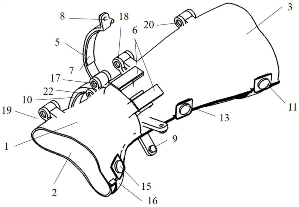 Traction type personalized bone fracture medical splint and using method