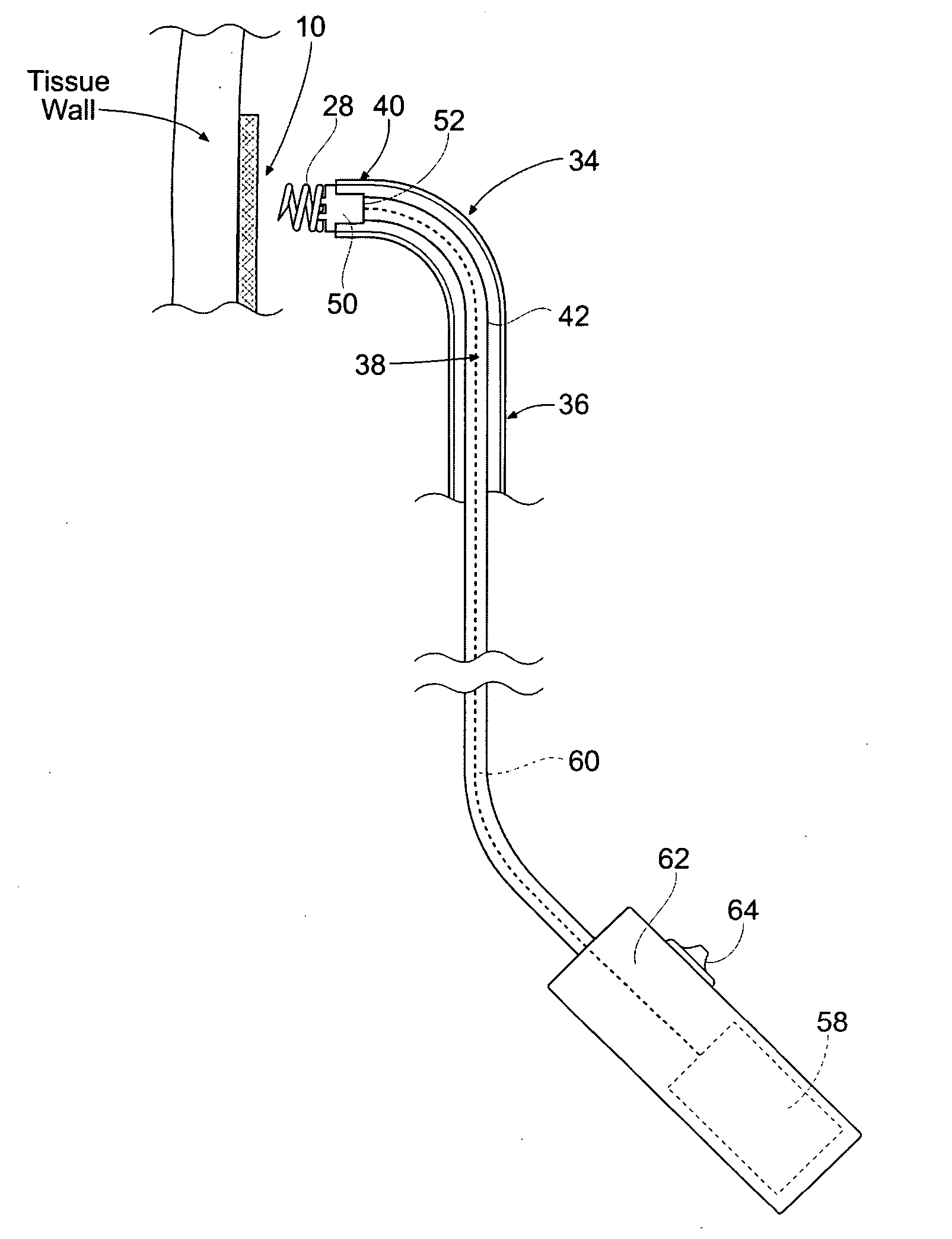 Systems and methods for attaching a prosthesis within a body lumen or hollow organ