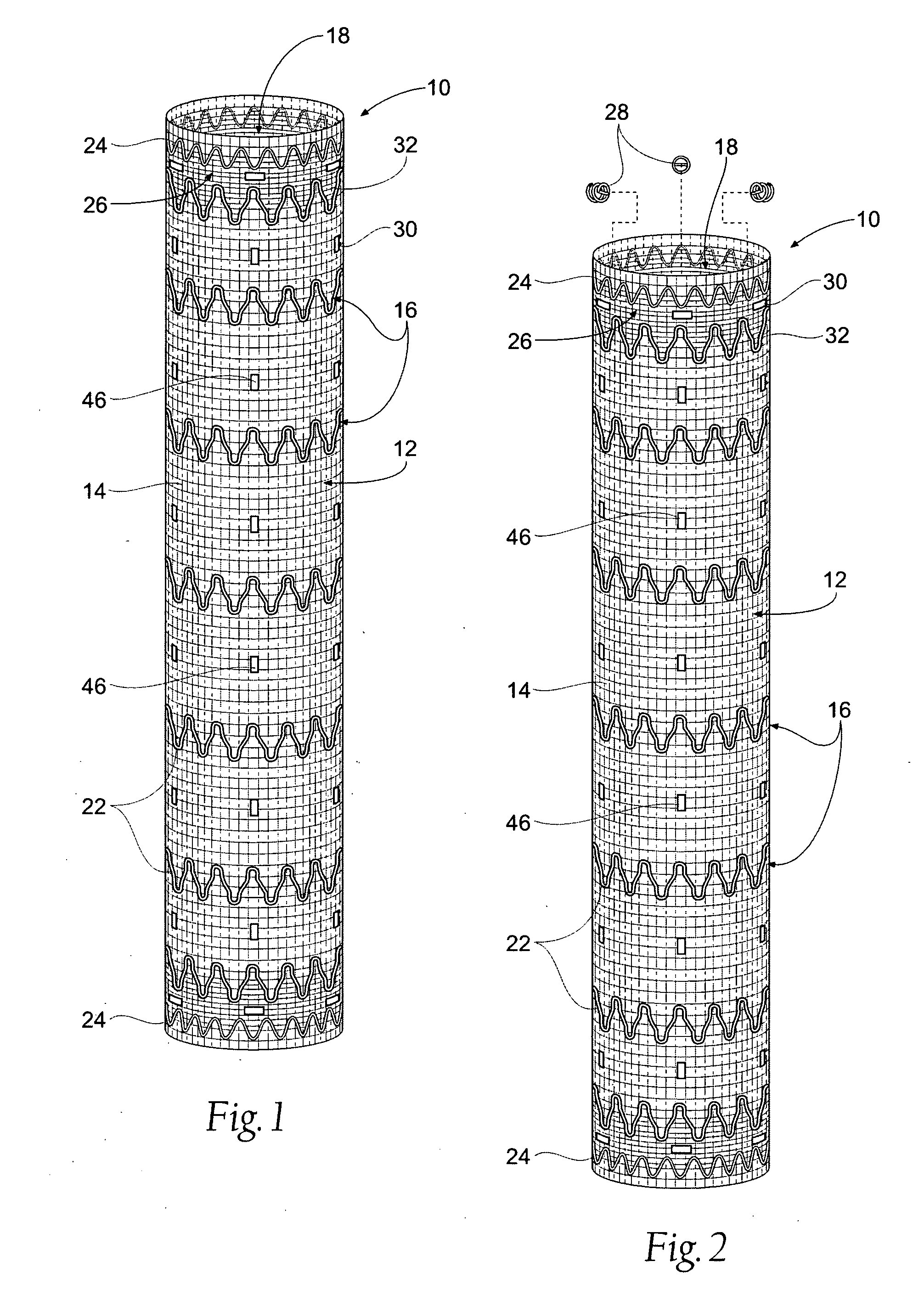Systems and methods for attaching a prosthesis within a body lumen or hollow organ