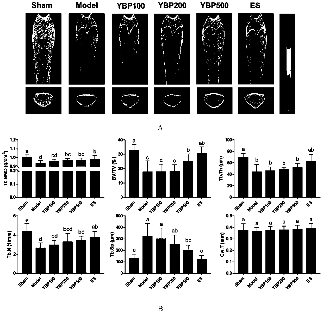 Biomarker for ossotide interventional therapy of osteoporosis, screening method and application