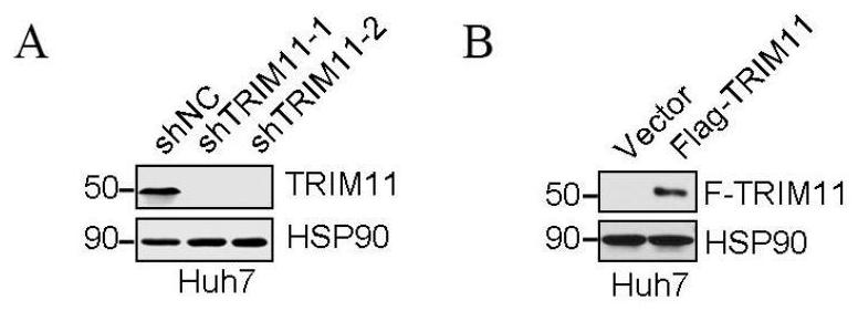 Application of composition of TRIM11 inhibitor and metformin in treatment of hepatocellular carcinoma