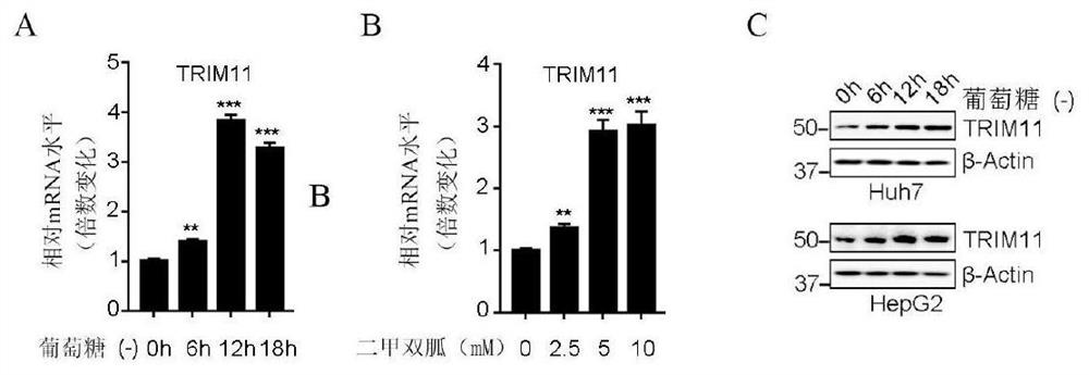 Application of composition of TRIM11 inhibitor and metformin in treatment of hepatocellular carcinoma