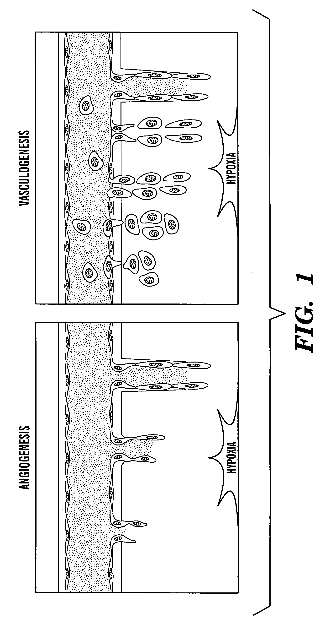 Method of treating or preventing pathologic effects of acute increases in hyperglycemia and/or acute increases of free fatty acid flux