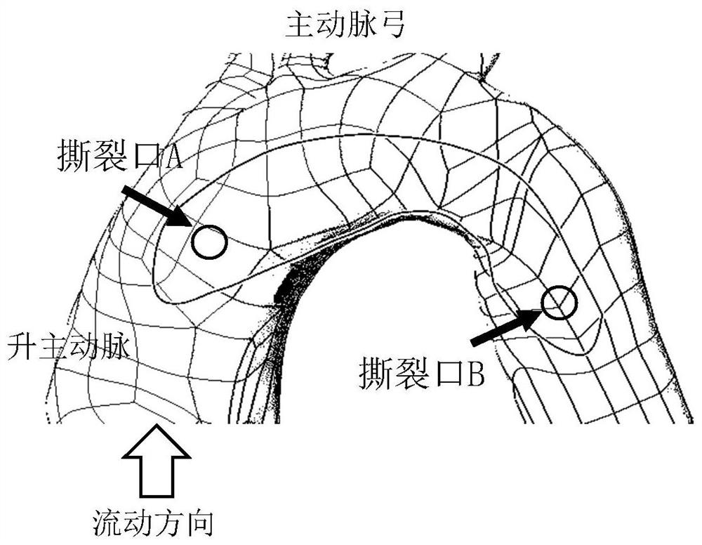 Manufacturing method of personalized extracorporeal interlayer physical model