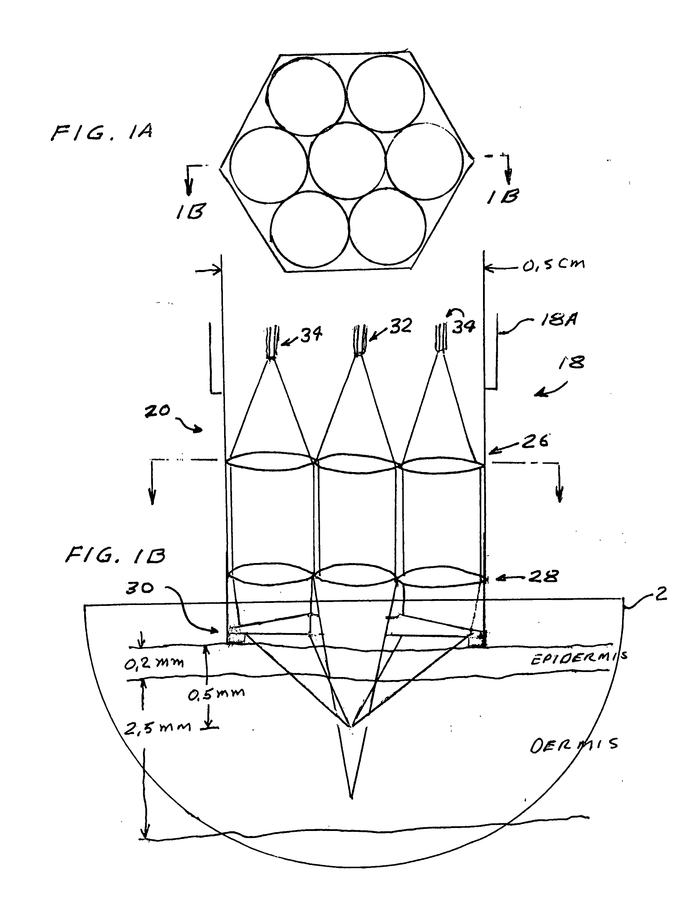 Laser treatment system and method for producing thermal cavities and energy droplets