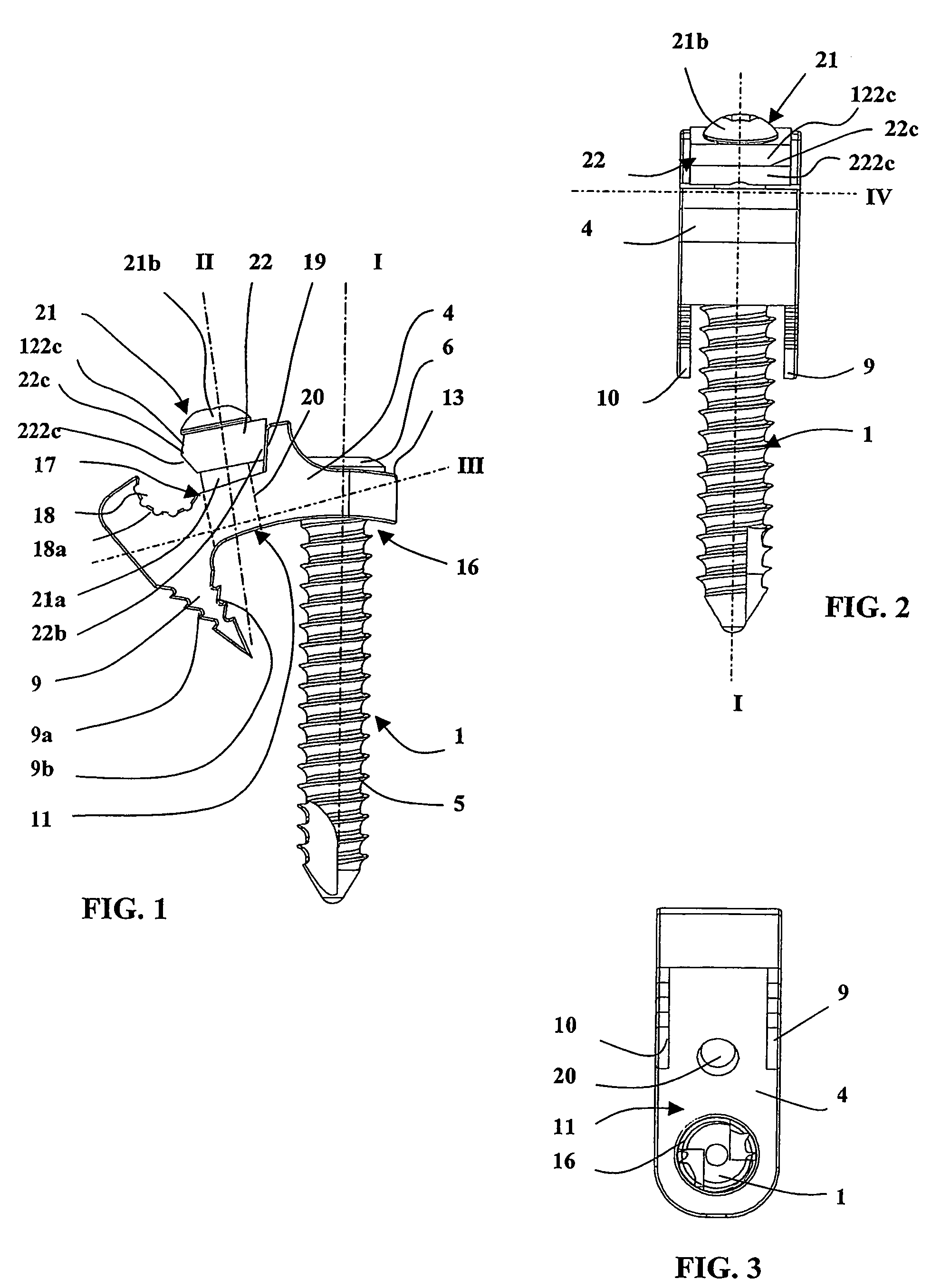 Device comprising anterior plate for vertebral column support