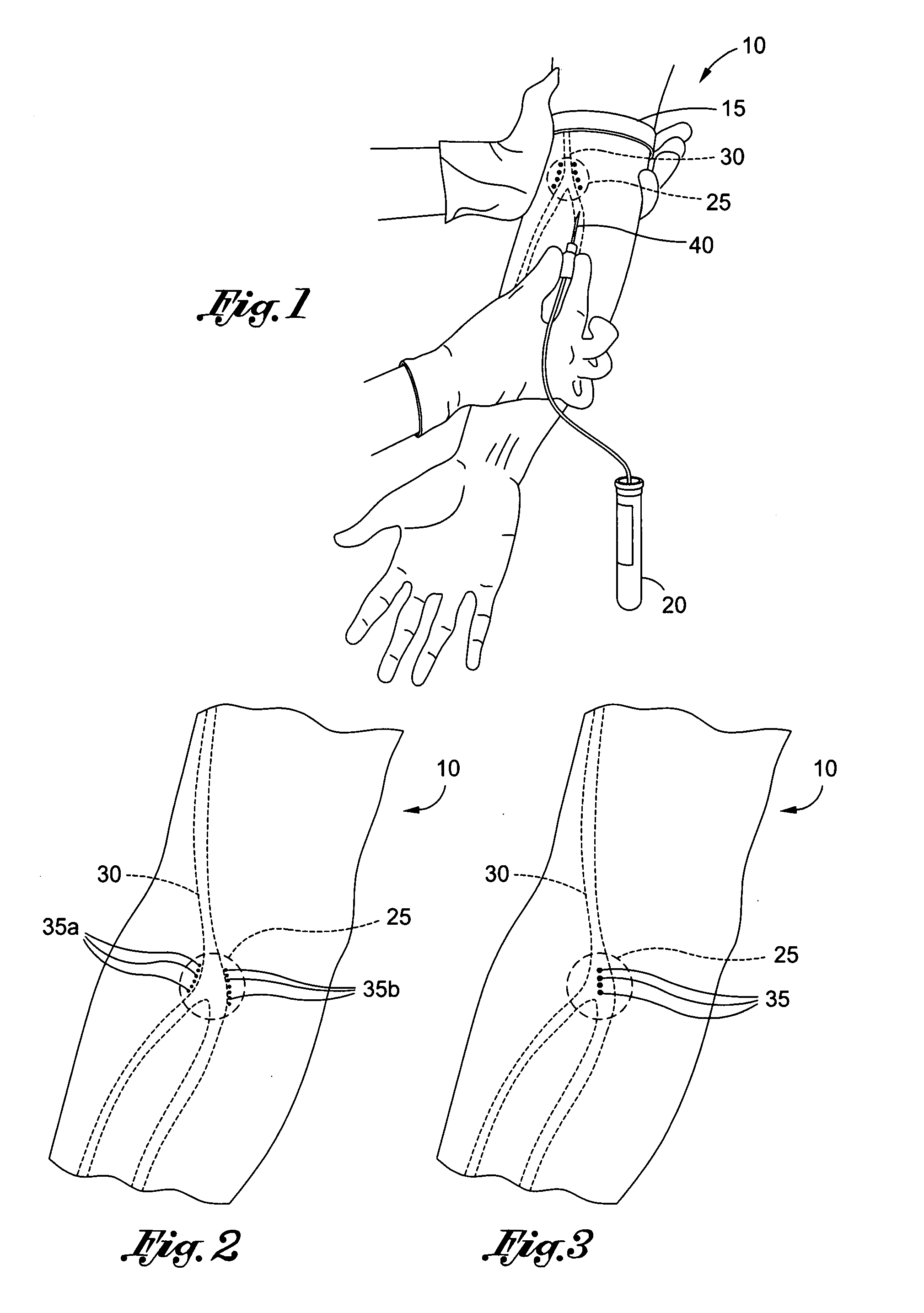 Method of locating vessel puncture access sites via tattoo or permanent marking