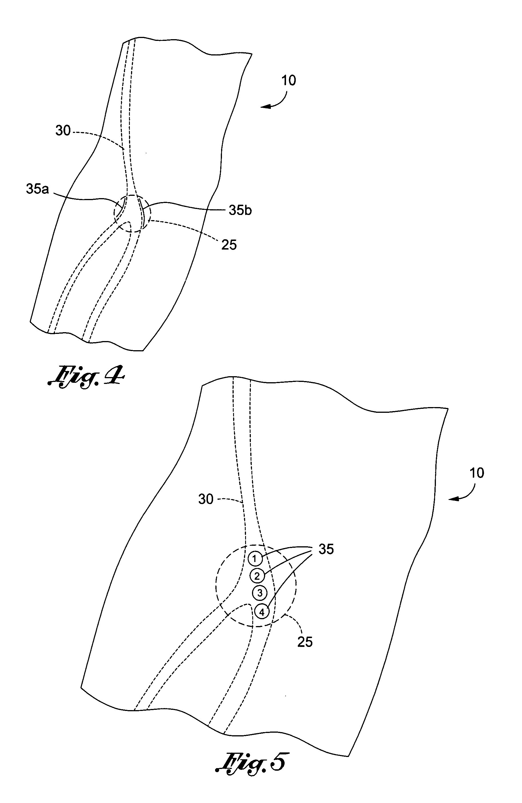 Method of locating vessel puncture access sites via tattoo or permanent marking