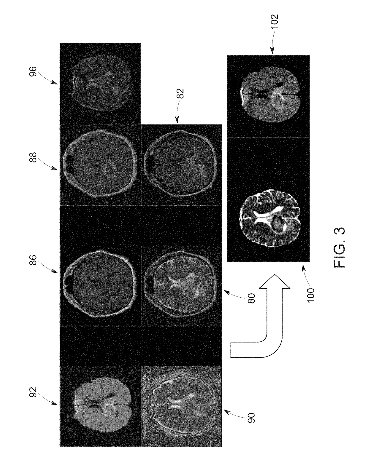 Physiology maps from multi-parametric radiology data