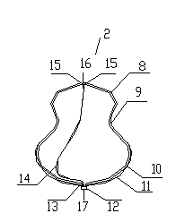 Developable sealed type woven body implantation material and conveying device