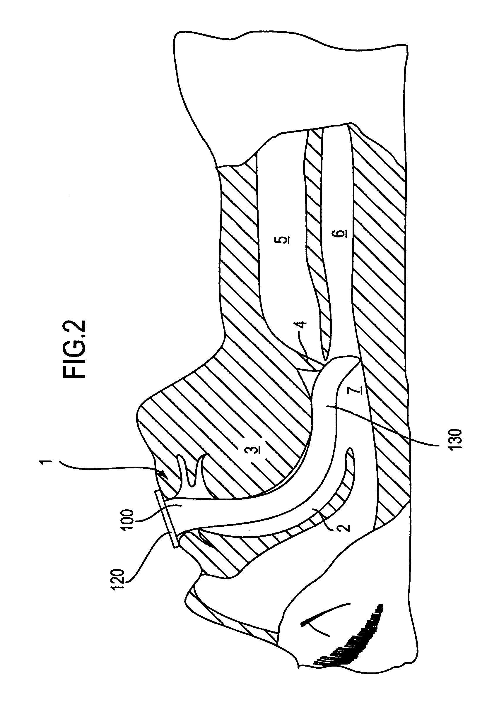 Perilaryngeal oral airway with temperature sensor