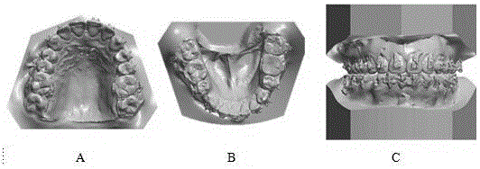 Method for building three-dimensional tooth-and-jaw fusion model