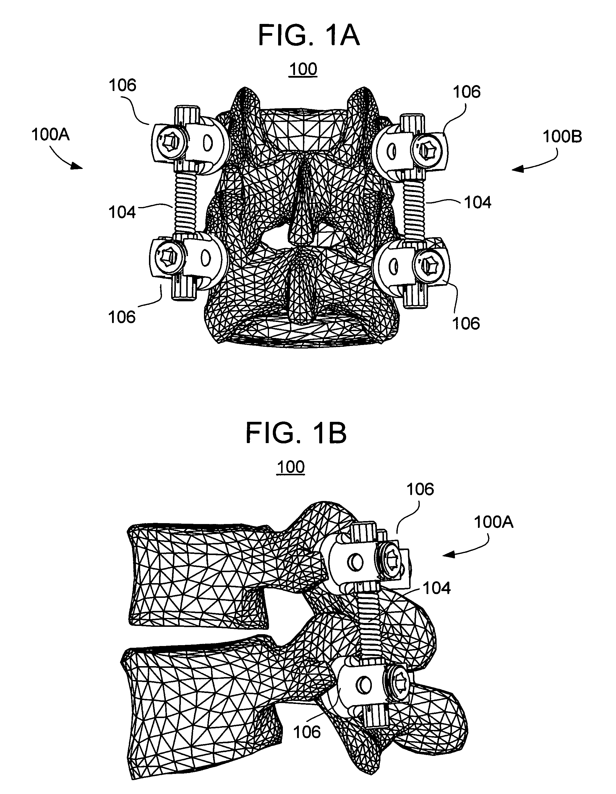 Methods and apparatus for vertebral stabilization using sleeved springs