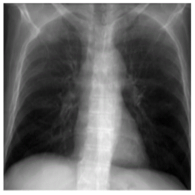 Method for generating dual-energy x-ray ct images from single-source single-scan x-ray ct images