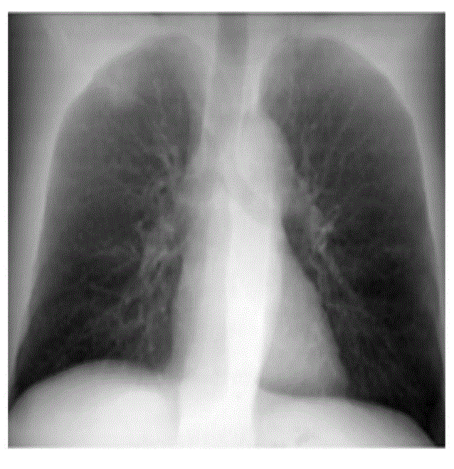 Method for generating dual-energy x-ray ct images from single-source single-scan x-ray ct images