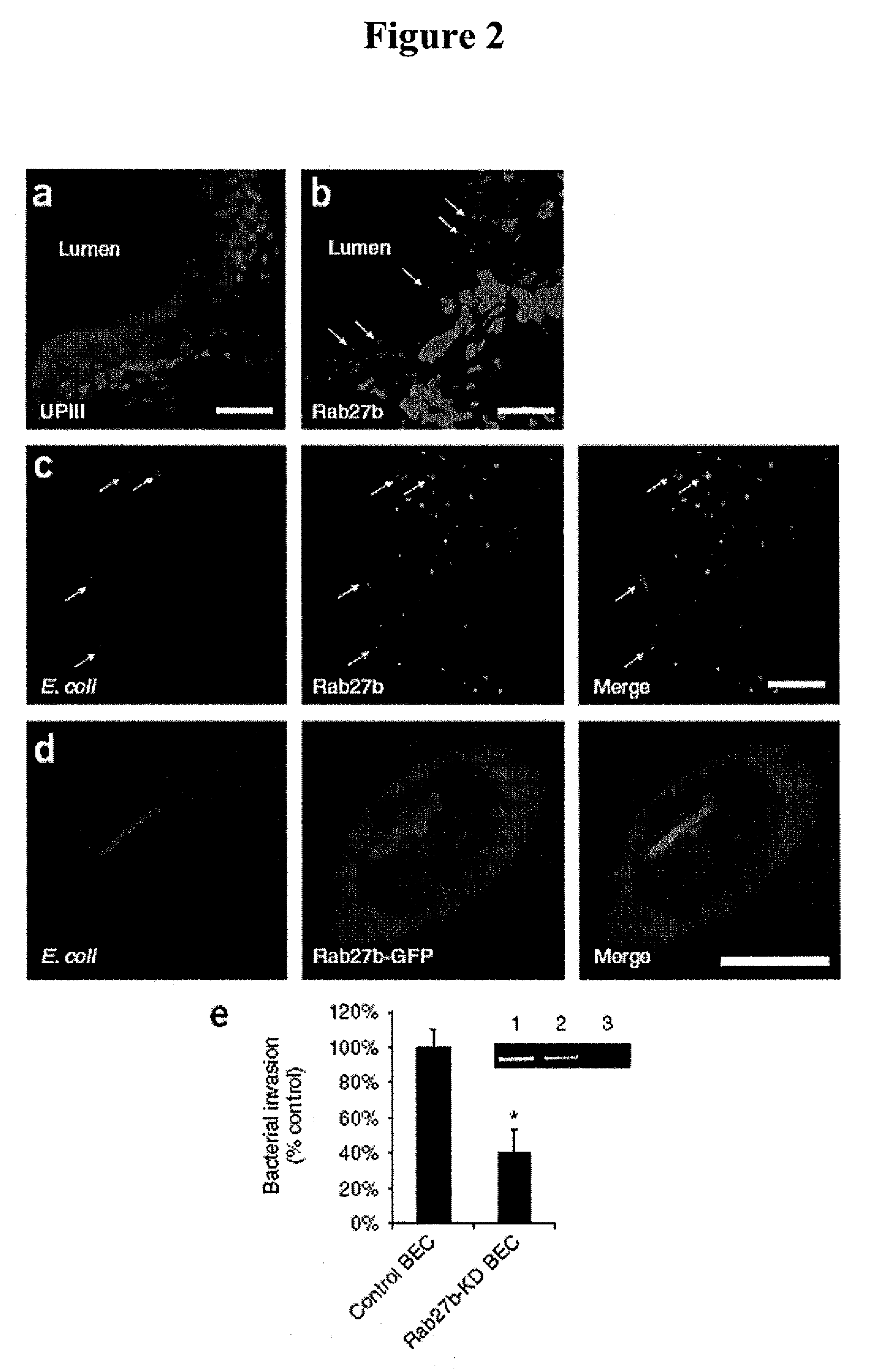 Methods and compositions for treating urinary tract infections using agents that mimic or elevate cyclic amp