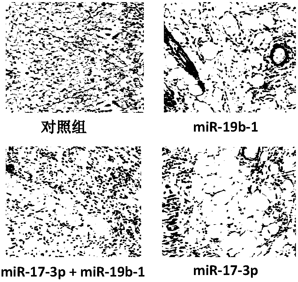 Compositions of mirna-17-3p and mirna-19b-1 and applications thereof