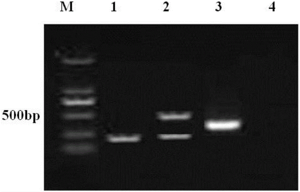 Multiple RT-PCR detection kit for identifying PRRSV (Porcine Reproductive and Respiratory Syndrome)