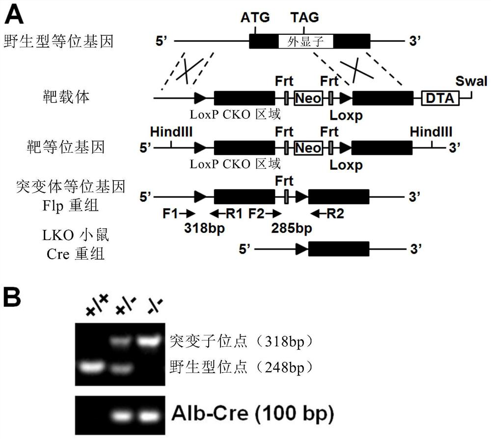 Application of crebzf in the treatment, prevention and diagnosis of metabolic diseases