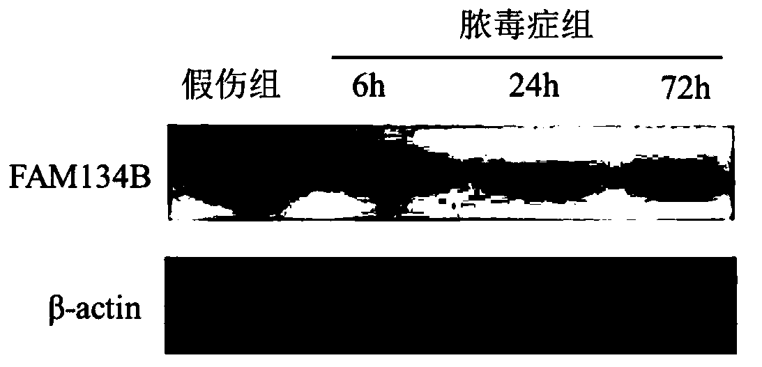 Use of fam134b in the preparation of medicines for treating sepsis