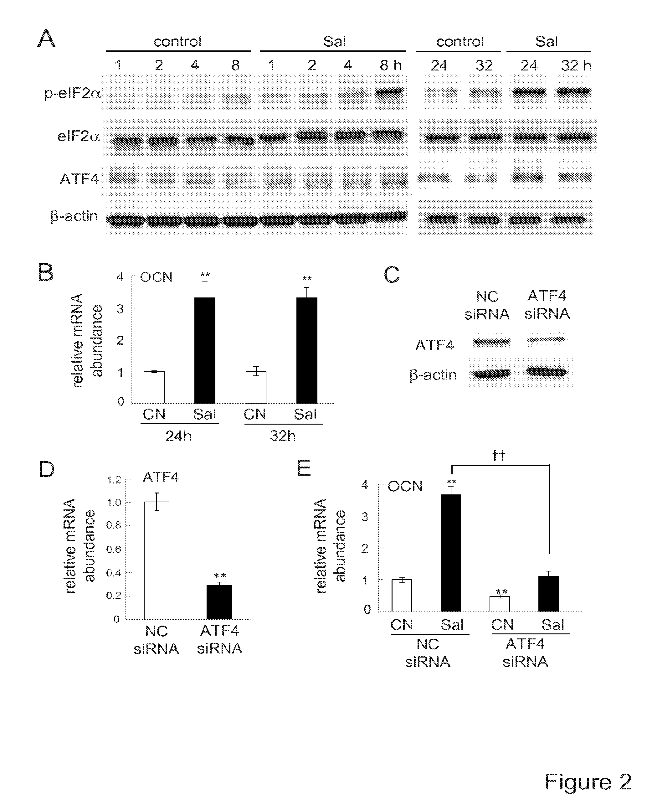 Compositions and methods for treating bone diseases