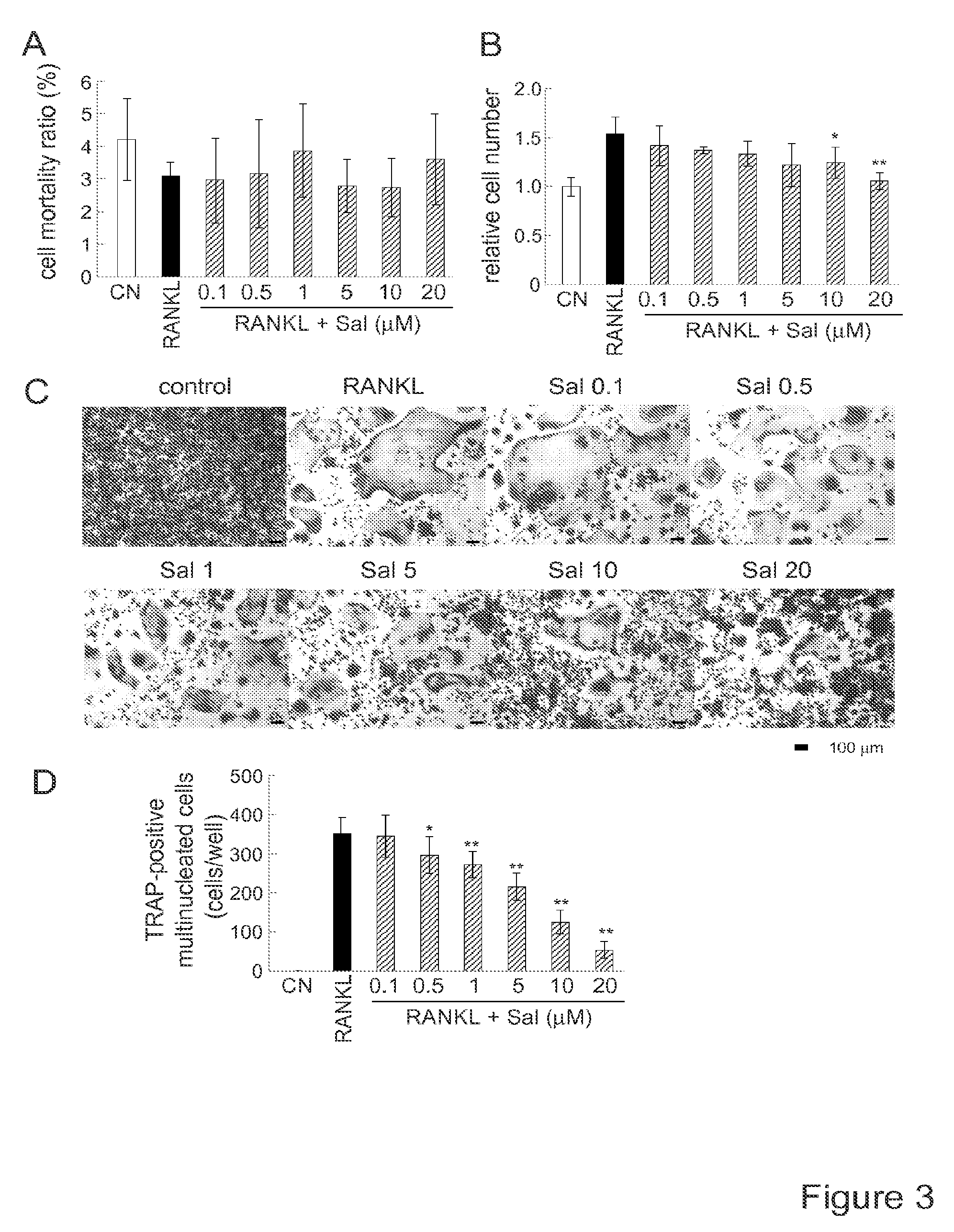 Compositions and methods for treating bone diseases