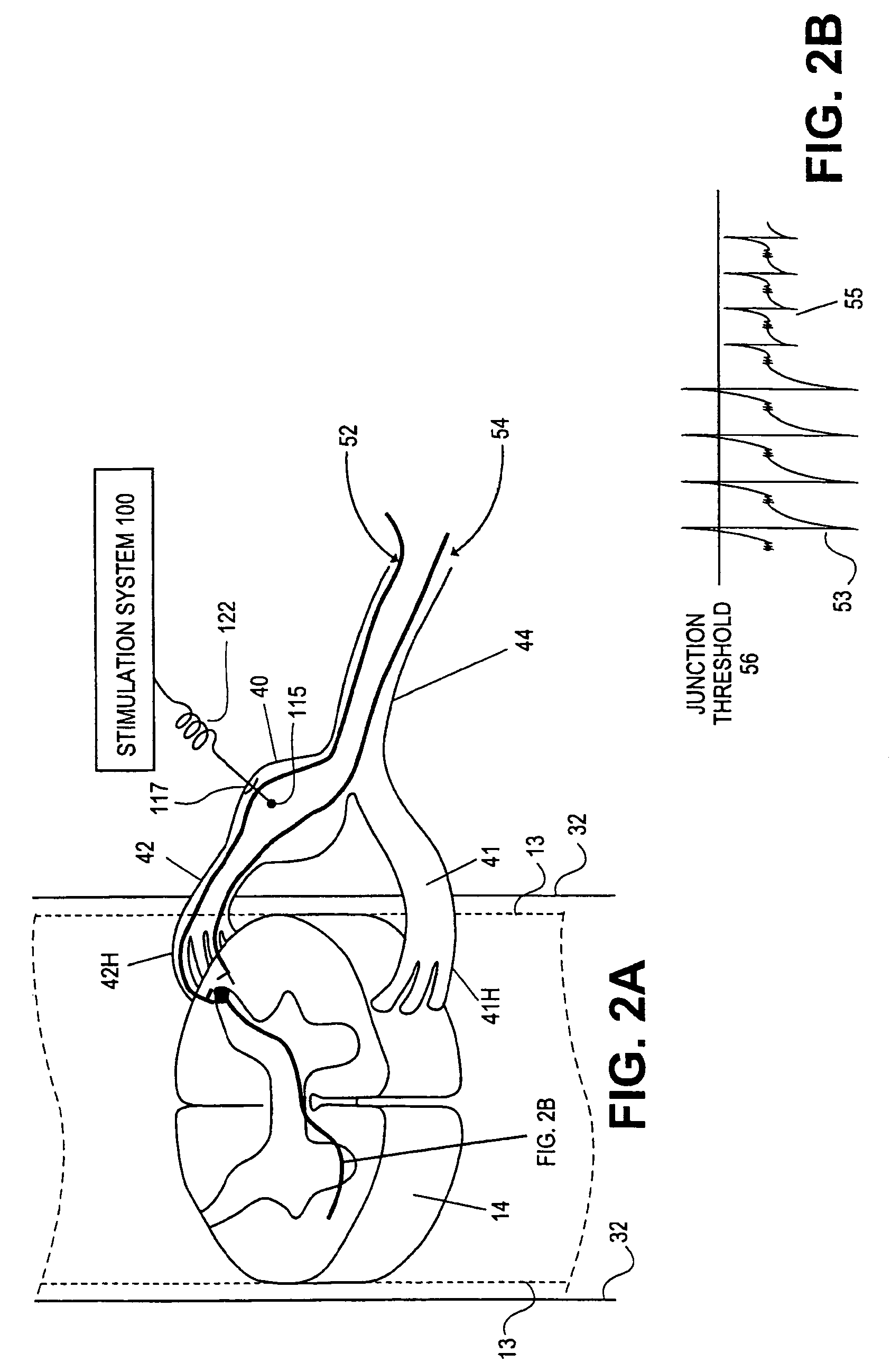 Methods and systems for modulating neural tissue