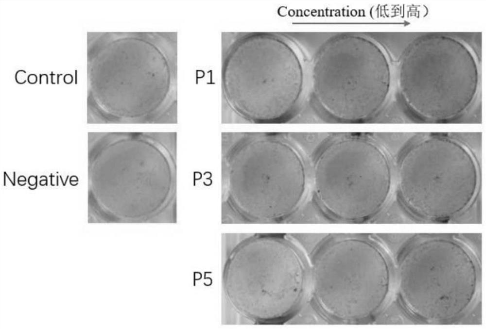 A kind of fish skin collagen polypeptide and its preparation method and application