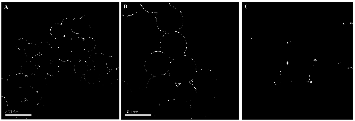 Mesoporous carbon nanoparticles and application thereof